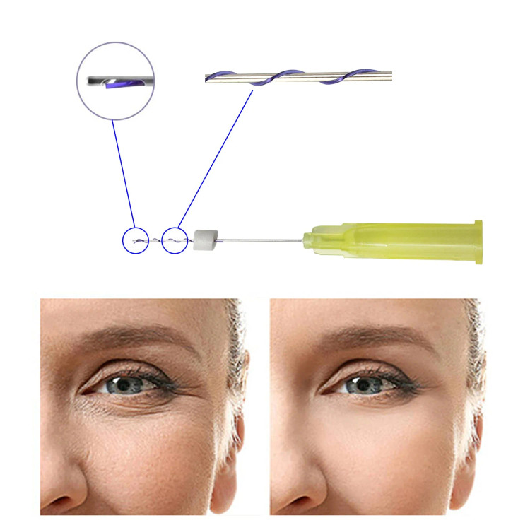 نخ PDO EYE LINE 30G25بسته ۲۰ تایی فادنو